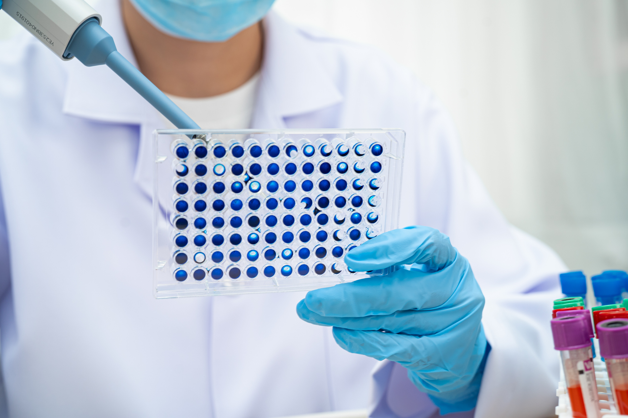 Scientist holding a sample microplate and pipette in a laboratory